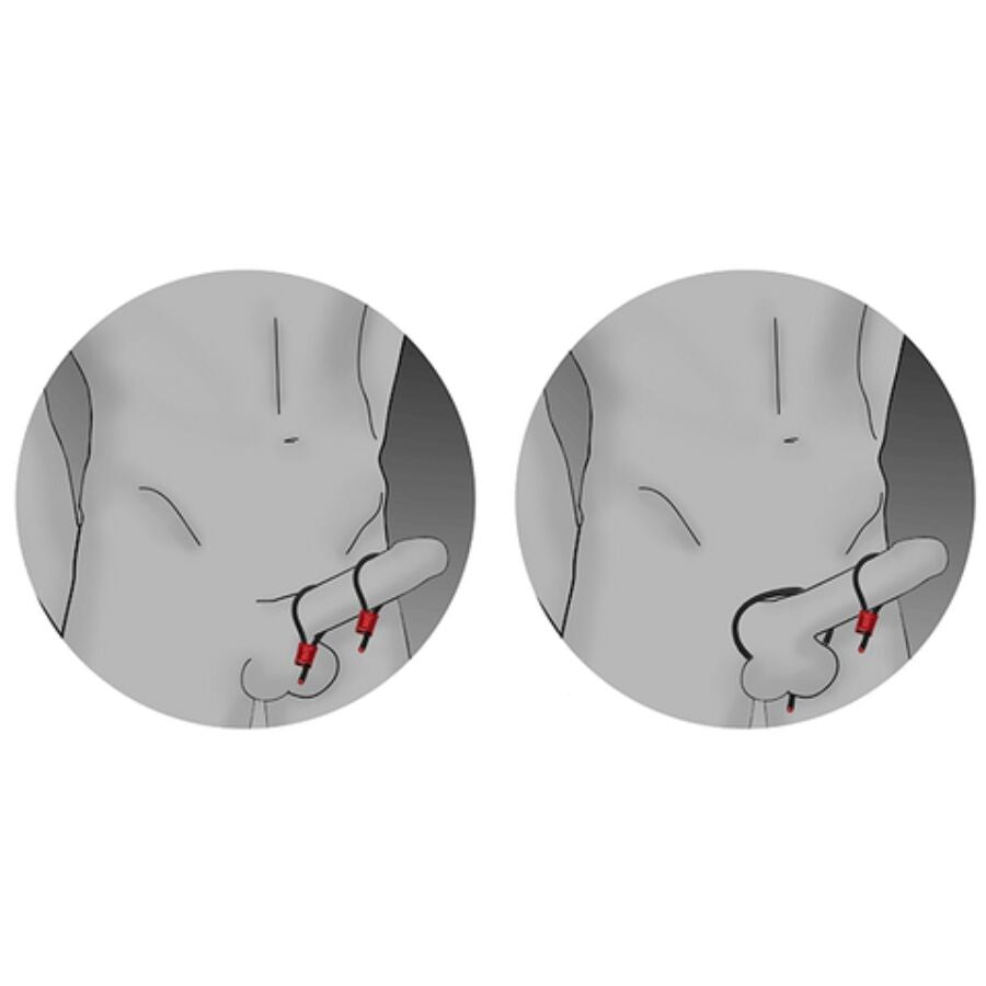 ELECTRASTIM - PRESTIGE ELECTRA LOOPS ANILLOS DE PENE AJUSTABLES ROJO